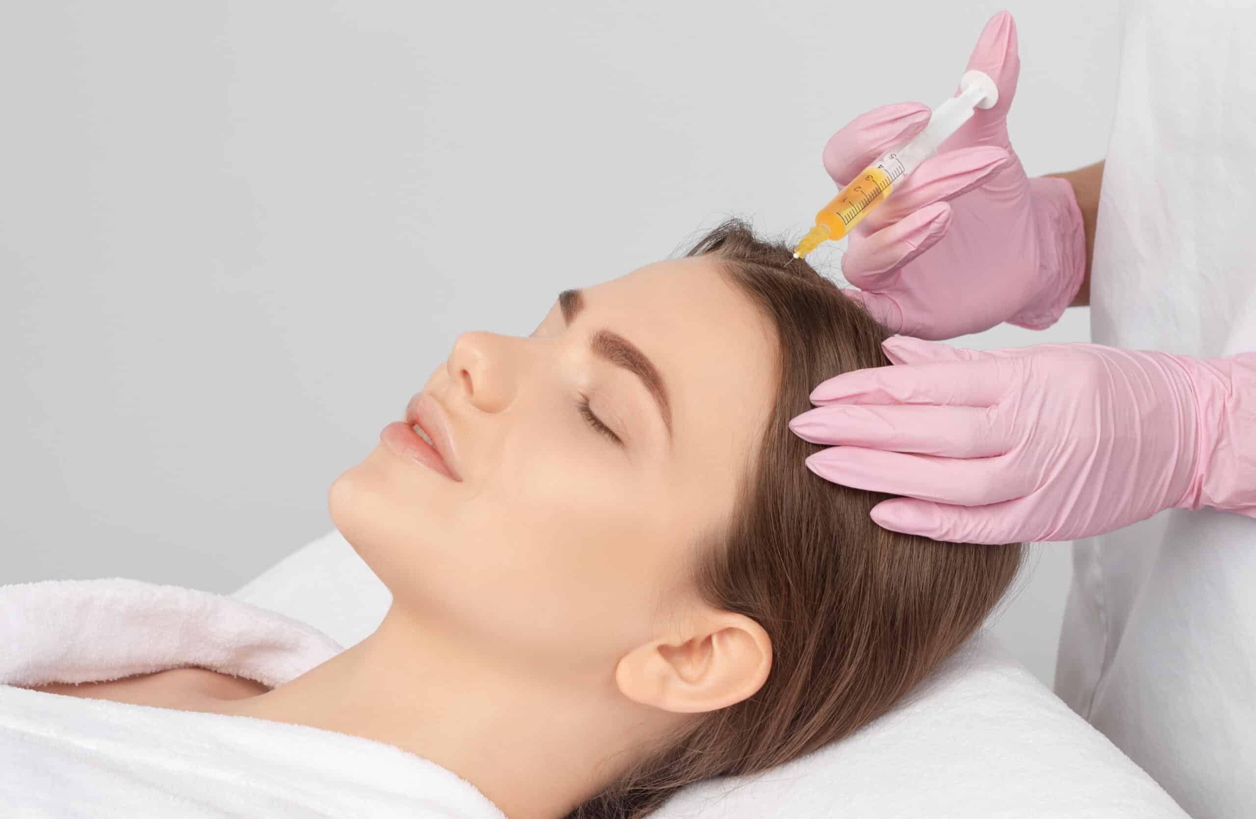 PRF hair treatment